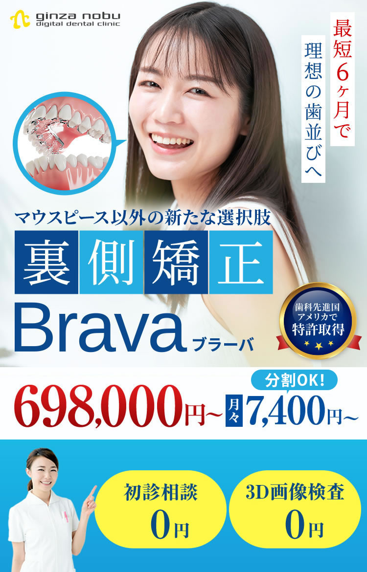 裏側矯正Brava(ブラーバ)