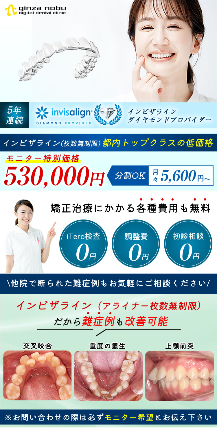 世田谷区上野毛の矯正歯科｜マウスピース矯正期間を20～50％短縮