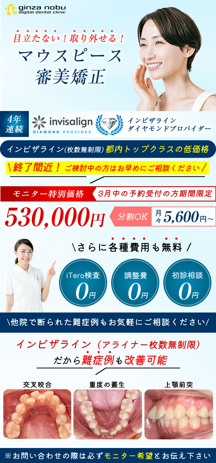 インビザラインキャンペーン